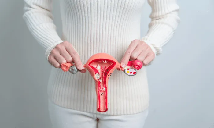 Uterine Fibroid Treatment in Ayurveda: Natural Healing Approach